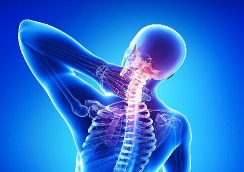 cervical osteochondria