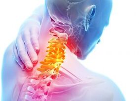 Pain and shelters in the cervical zone